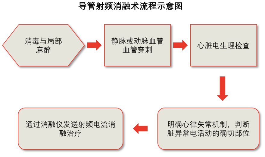 导管射频消融术流程示意图