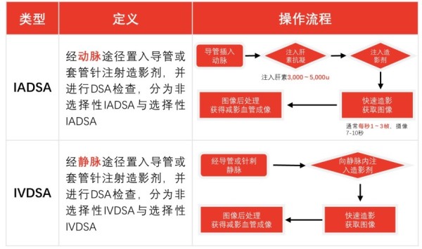中国血管造影设备行业市场综述——DSA检查分类及操作流程