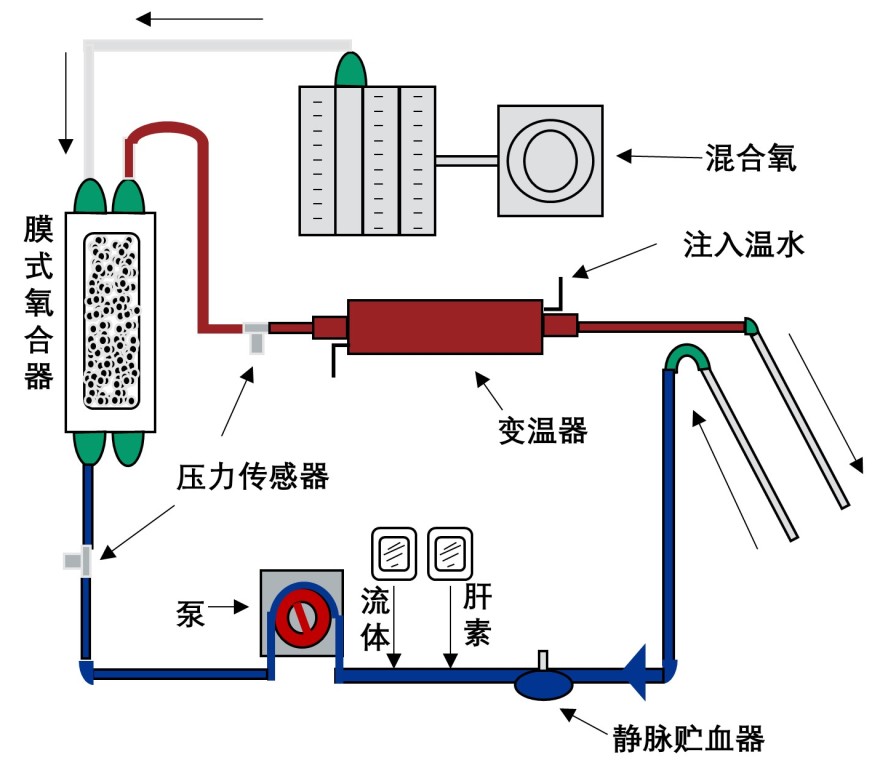 ecmo原理图解图片